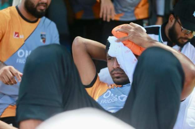 बांग्लादेश: क्रिकेट खिलाड़ी मुस्तफ़िज़ुर रहमान के सिर में लगी गेंद, अस्पताल में भर्ती