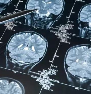केरल: दुर्लभ मस्तिष्क संक्रमण मेनिंगोएन्सेफलाइटिस से पांच साल की बच्ची की मौत