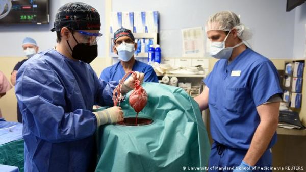 सुअर का दिल लगने के 2 महीने बाद ही मरने वाले मरीज में वायरस मिला