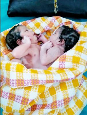 छाती से जुड़े बच्चों का जन्म, अलग करने डीकेएस अस्पताल भेजा