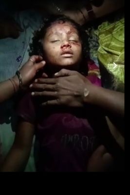 बिजनौर में तेंदुए के हमले में एक और पांच साल की बच्ची की गई जान