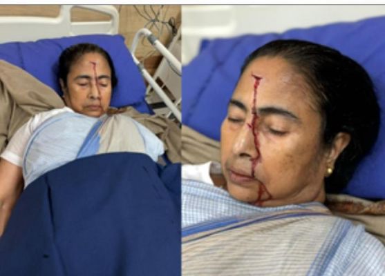 वरिष्ठ डॉक्टर और तृणमूल मंत्री का दावा, सीएम ममता बनर्जी की चोट क्षणिक बेहोशी का नतीजा
