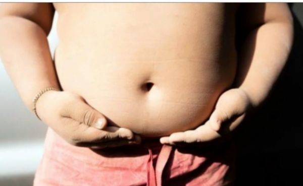 मात्र 39 वर्ष हो सकती है बचपन में गंभीर मोटापे से ग्रस्त हो चुके लोगों की जीवन प्रत्याशा : शोध