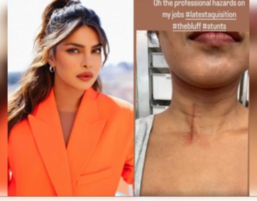 'द ब्लफ' के सेट पर स्टंट करते वक्त प्रियंका चोपड़ा की गर्दन पर आई चोट 