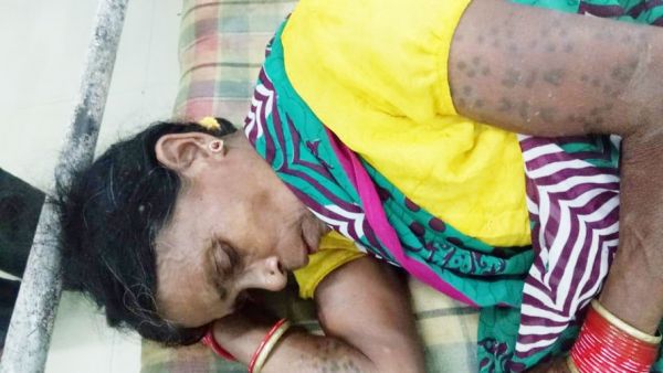 साप्ताहिक बाजार से लौट रहे ग्रामीणों की पिकअप पलटी, 2 की मौत , 14 घायल