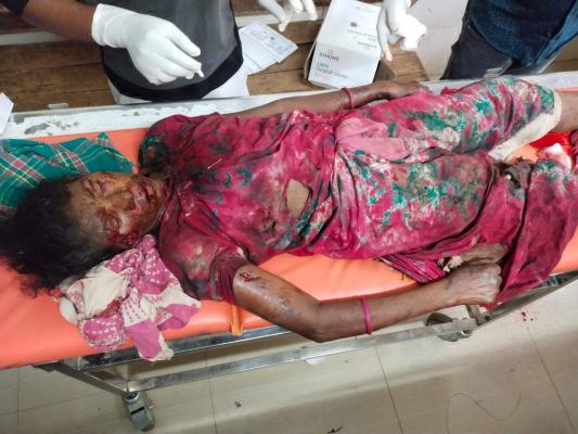 प्रेशर बम की चपेट में महिला घायल