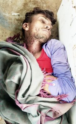 गाज से बालिका और 2 युवाओं की मौत