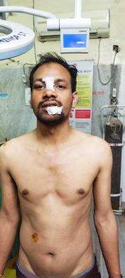 भाजपा नेता ने विवाद के बाद चिकित्सक को पीटा, मुंह और चेहरे में चोंट