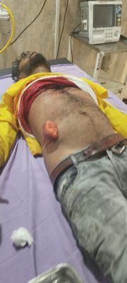 समाज अध्यक्ष पर दो सगे भाईयों ने रैली में किया कातिलाना हमला