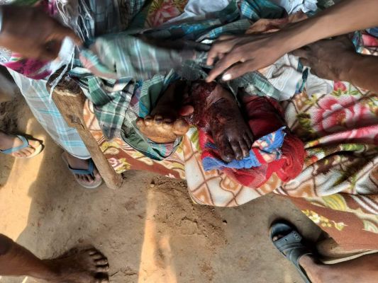 नक्सलियों के लगाये आईईडी की चपेट में ग्रामीण की मौत