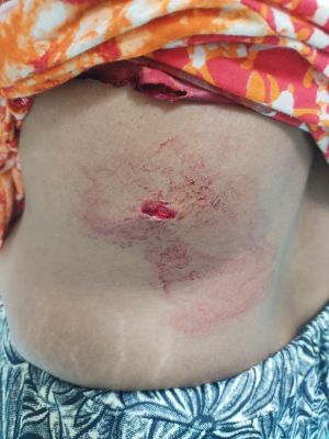 किराना दुकानदार महिला पर चाकू से वार, युवक के पेट पर लात से हमला